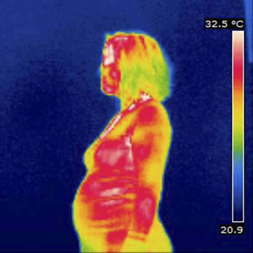 AVFCA Thermography