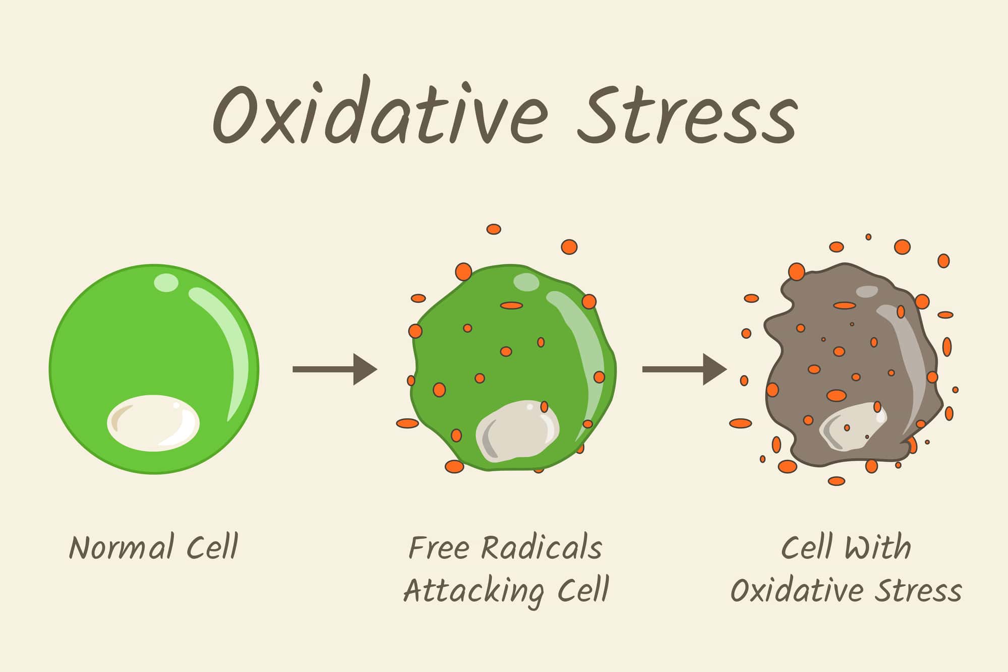 AVFCA oxidative stress