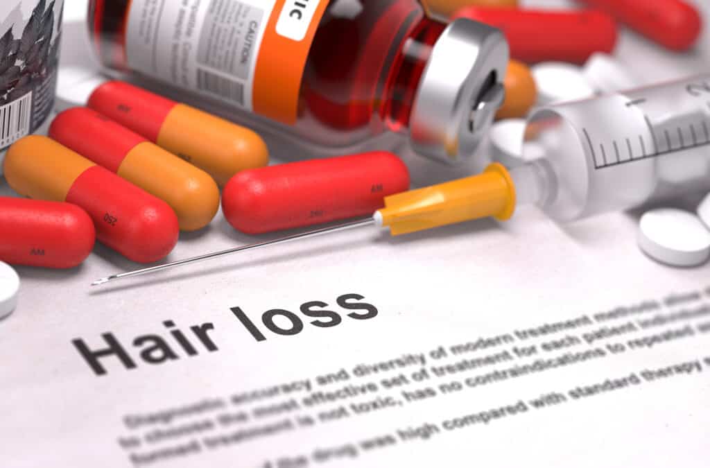 medical treatments for women's hair loss