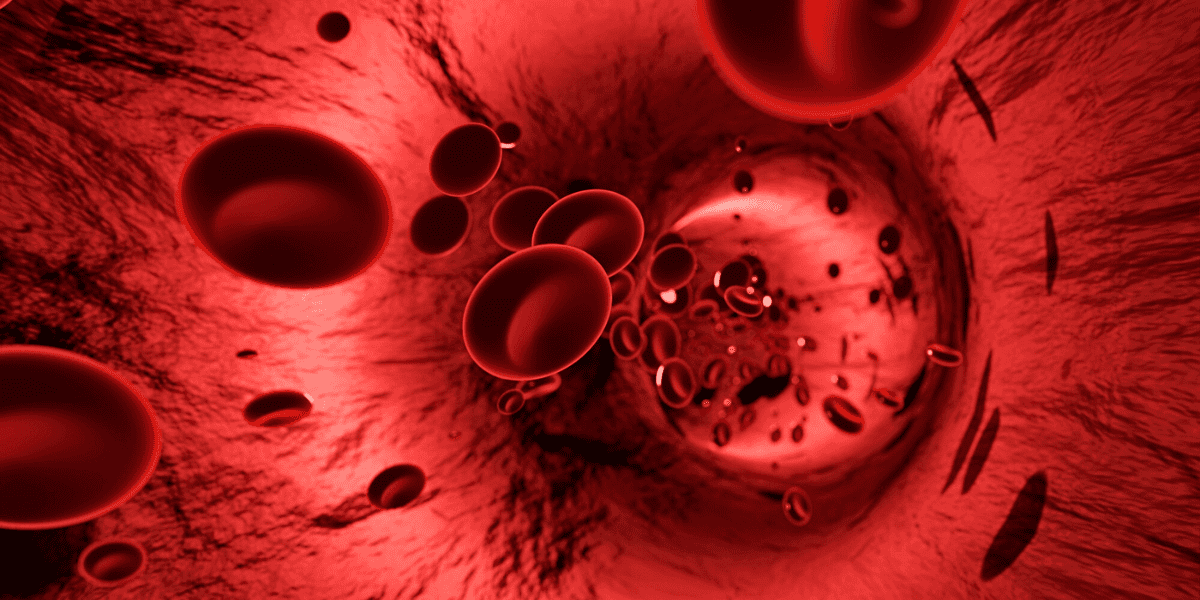 UV blood irradiation treatment