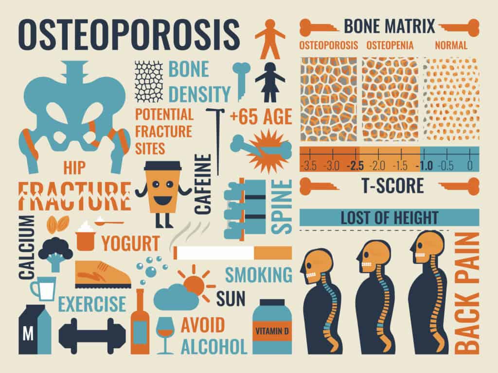 what the medical industry hides about osteoporosis