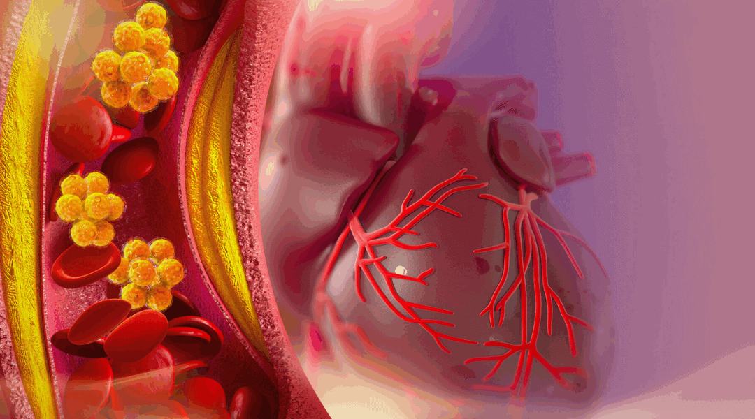 Moving the Bar: The Evolution of Cardiovascular Health Standards and the Impact of Lowered Risk Markers on Public Health
