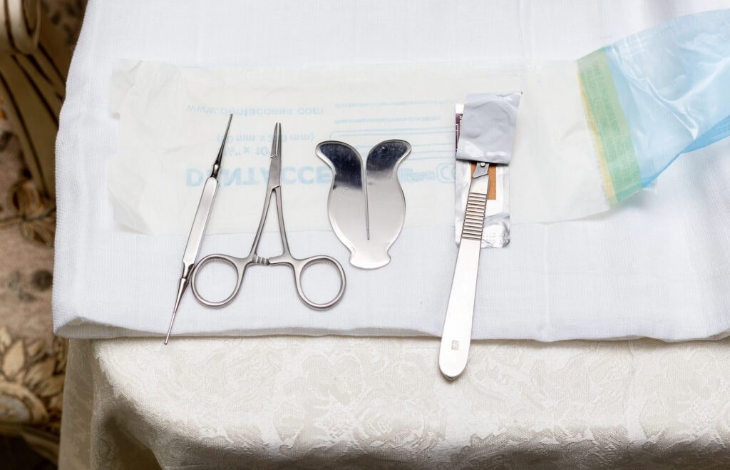 what is the circumcision procedure? 