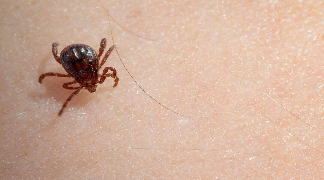 The Unanswered Questions of Lyme Disease