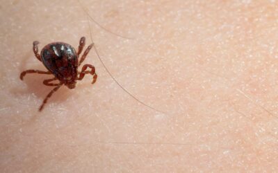 The Unanswered Questions of Lyme Disease