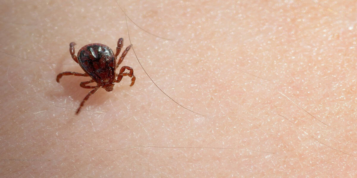 lyme disease natural treatment