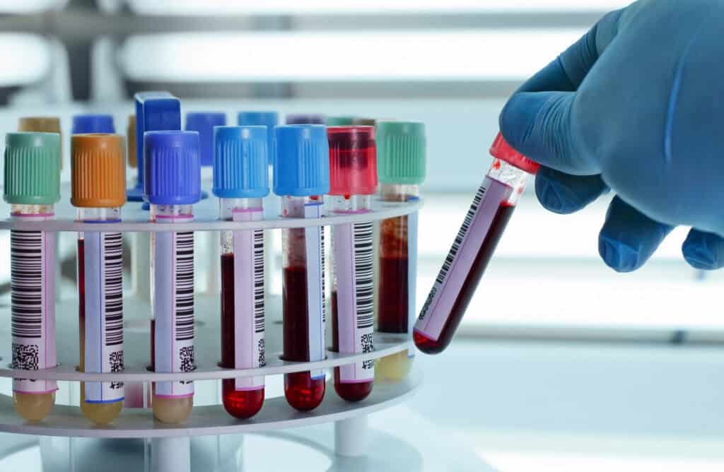 what blood tests for functional medicine? 